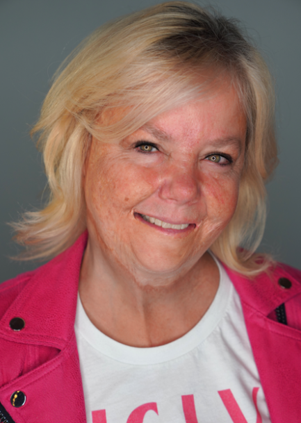 Kelly Woodhouse